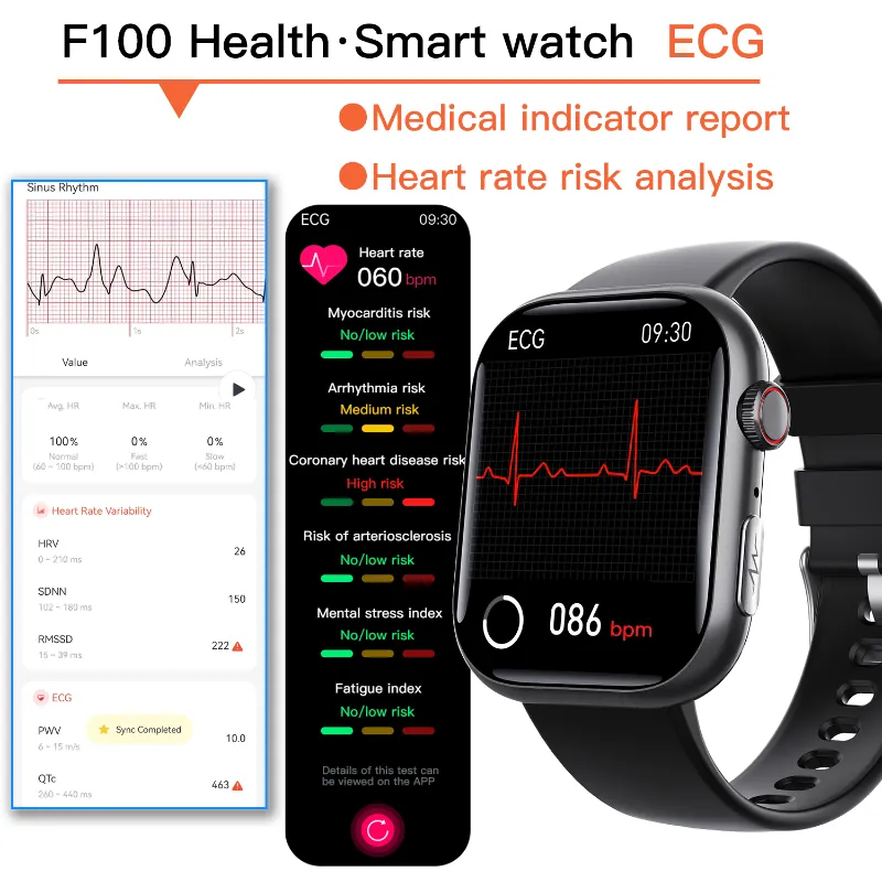 Best ECG Smart Watch of 2024 With Blood Pressure Monitor Blood Glucose Monitoring