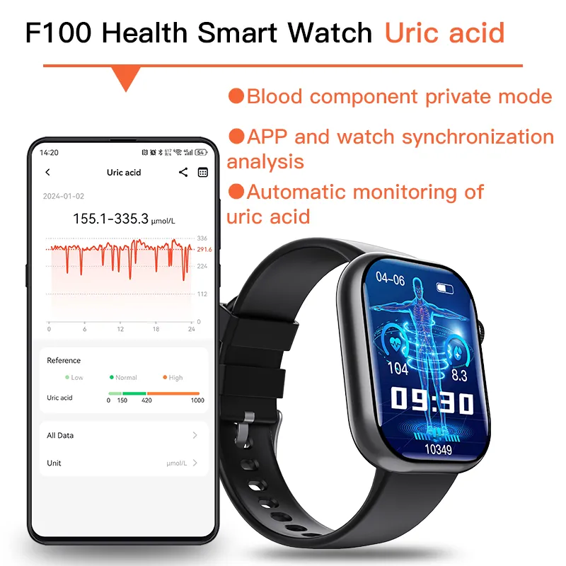 Best ECG Smart Watch of 2024 With Blood Pressure Monitor Blood Glucose Monitoring