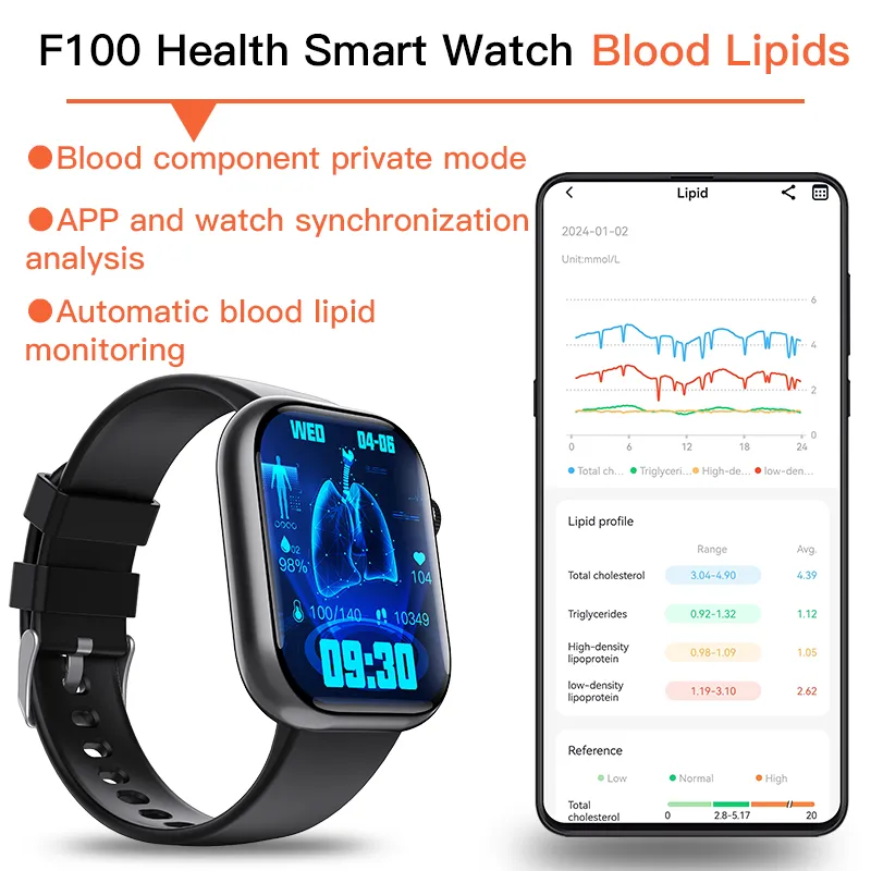 Best ECG Smart Watch of 2024 With Blood Pressure Monitor Blood Glucose Monitoring