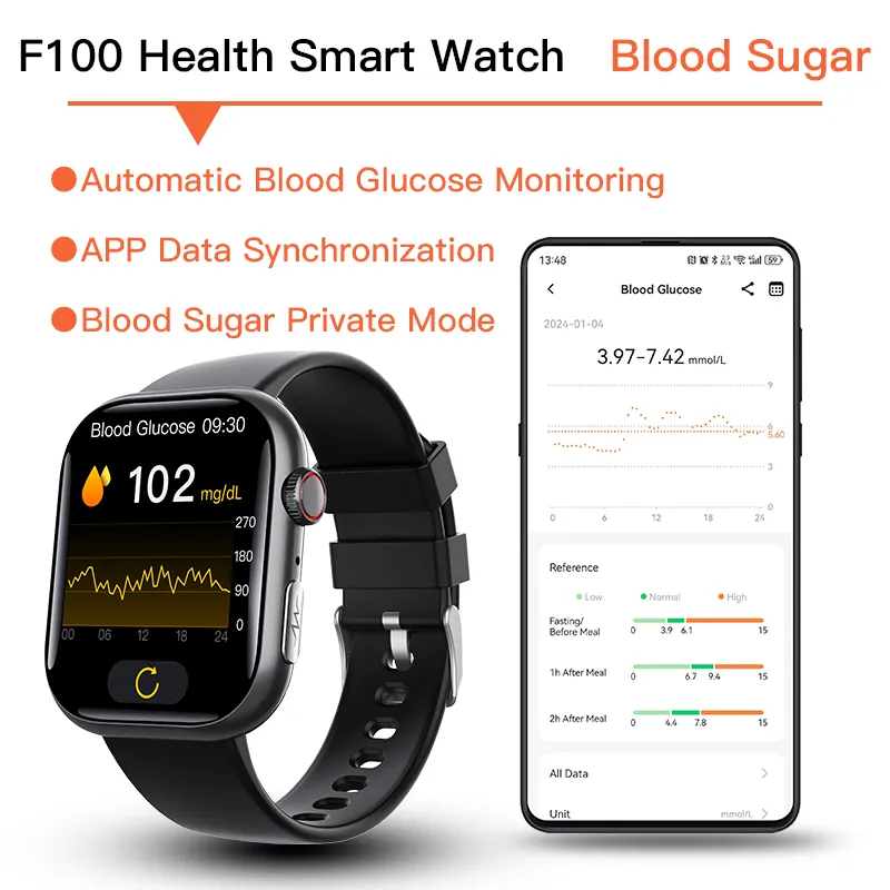 Best ECG Smart Watch of 2024 With Blood Pressure Monitor Blood Glucose Monitoring